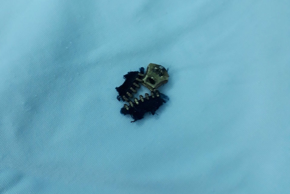 Chàng trai khóc thét, suýt tiêu của quý do khóa quần...quá bén