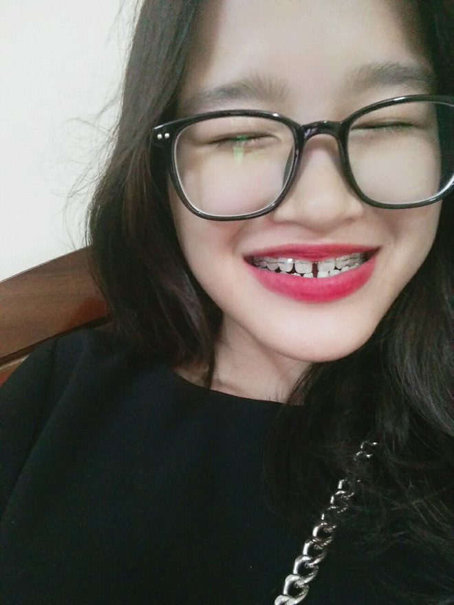 Cô bạn rất xinh cho đến khi nở nụ cười có quyết định đột phá sau 19 năm được dân tình ủng hộ 2 tay