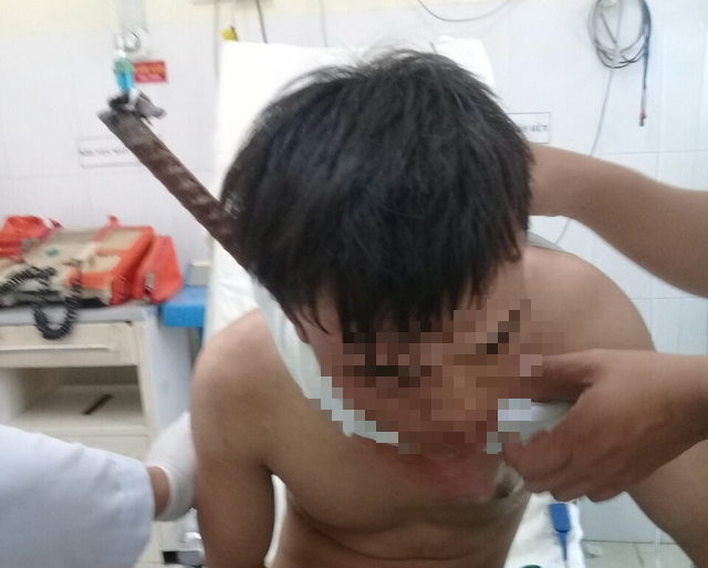 Một công nhân bị cây sắt đâm xuyên từ cổ xuống ngực