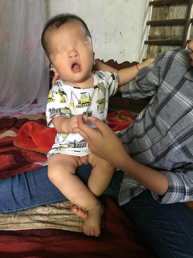 Số phận nghiệt ngã và khát vọng nhìn thấy ánh sáng của bé trai sinh ra không có đôi mắt