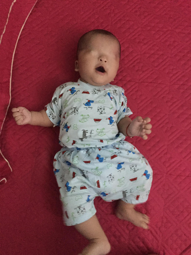 Số phận nghiệt ngã và khát vọng nhìn thấy ánh sáng của bé trai sinh ra không có đôi mắt