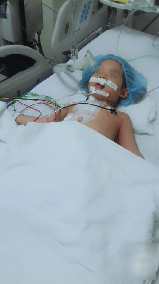 Cầm bút bi chạy chơi, bé gái 4 tuổi bị bút đâm xuyên thấu ngực