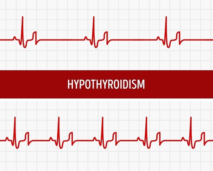 10 dấu hiệu tuyến giáp của bạn không hoạt động đúng