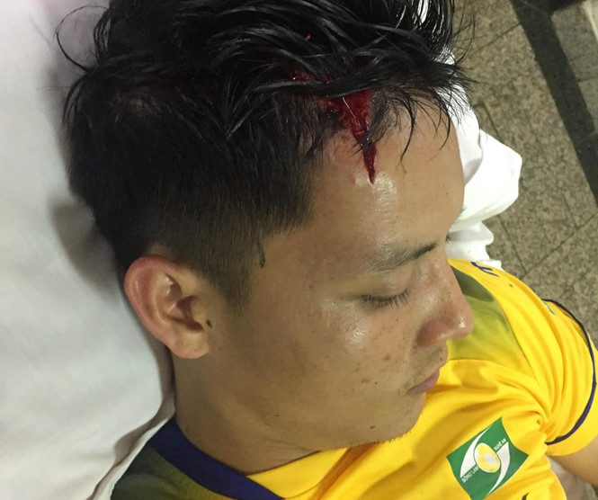 2 cựu trung vệ U.19 Việt Nam nhập viện sau trận HAGL - SLNA