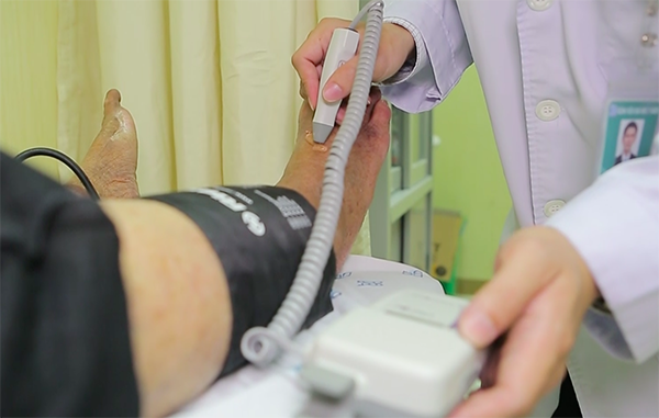 Nguy cơ cụt chân do biến chứng tiểu đường