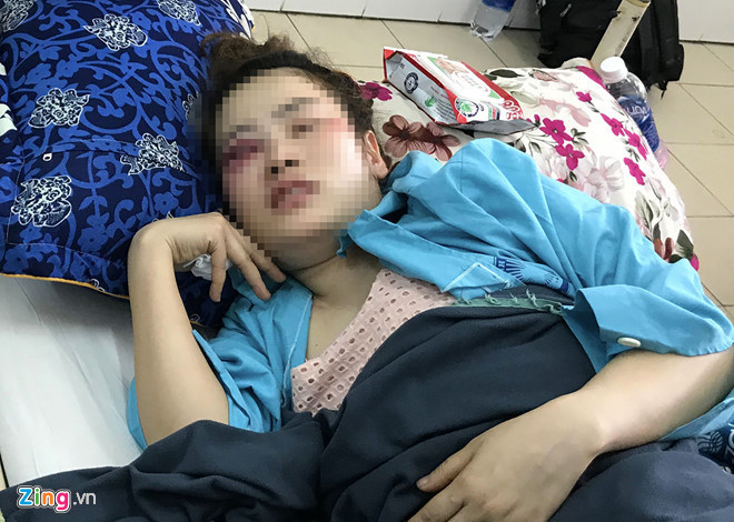 Nam thanh niên đánh cô gái tại quán bánh xèo bị phạt 1,5 triệu