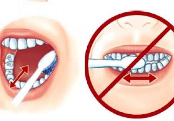 Thói quen đánh răng sai 90% người mắc phải: Làm ướt bàn chải trước khi đánh răng Thói quen đánh răng sai 90% người mắc phải: Làm ướt bàn chải trước khi đánh răng