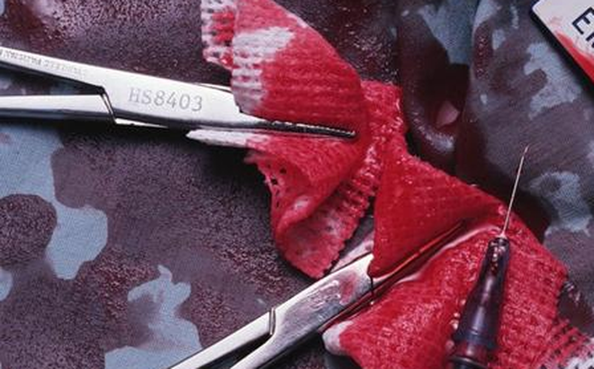 Bác sĩ bỏ quên gạc trong bụng bệnh nhân 15 ngày