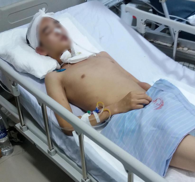 Truy tìm chiếc ô tô trong vụ tai nạn khiến nam thanh niên chấn thương sọ não