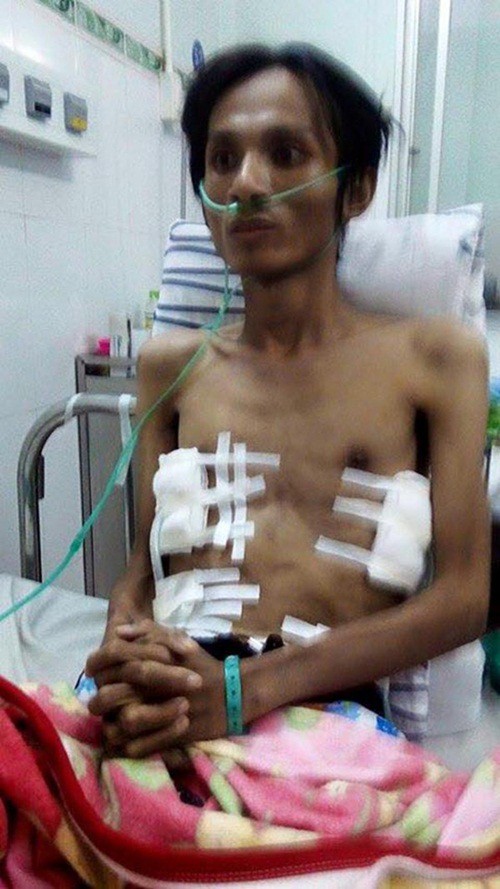 Từng chỉ còn da bọc xương vì bệnh phổi, Thái Lan Viên khoe ảnh hiện tại khiến dân tình không khỏi bất ngờ! Từng chỉ còn da bọc xương vì bệnh phổi, Thái Lan Viên khoe ảnh hiện tại khiến dân tình không khỏi bất ngờ!