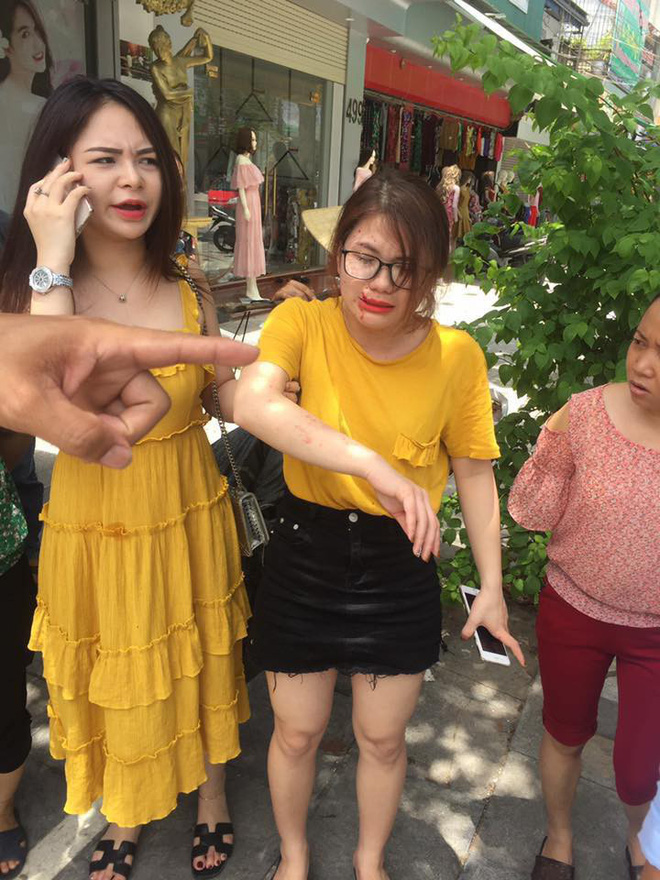 Thanh Hóa: Một phụ nữ bị thương sau tiếng nổ lớn ở shop quần áo chuẩn bị khai trương