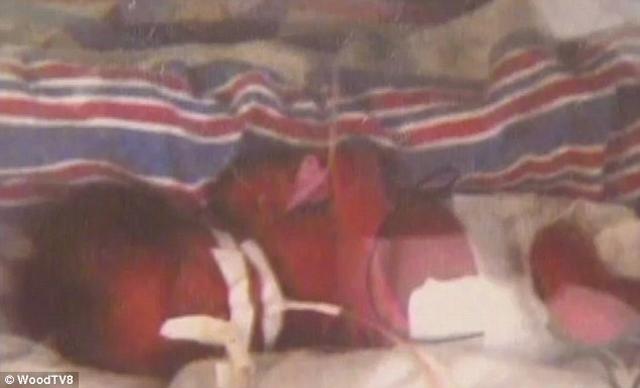 Người mẹ đã chết 42 ngày vẫn hạ sinh hai cậu bé sinh đôi khỏe mạnh