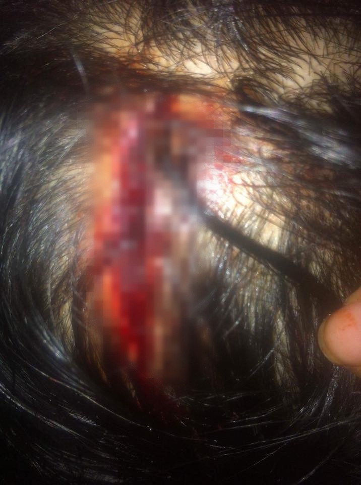 Bầu vượt mặt 9 tháng, người vợ trẻ phải livestream vì bị chồng đánh tới tấp, bầm tím mắt do nằm nghỉ không trông con