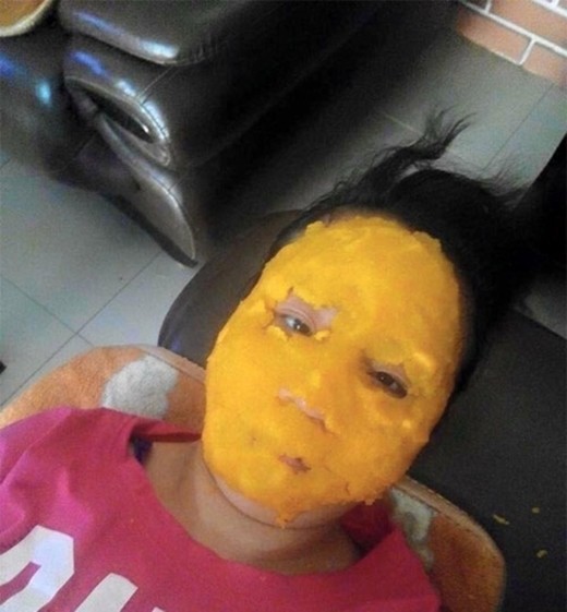 Đi chơi về muộn, cô gái phát hoảng khi nhìn thấy khuôn mặt biến dạng của mẹ nằm ở trên giường