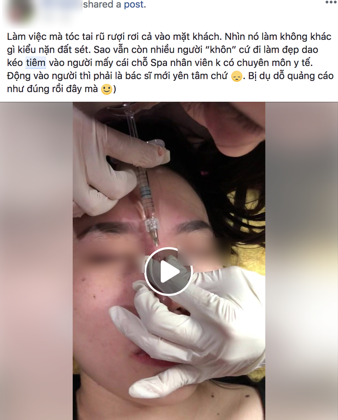 Clip tiêm Filler vào mũi sau đó bóp nặn thành dáng cao dài thẳng tắp đang được nhiều chị em chia sẻ vì... quá đáng sợ