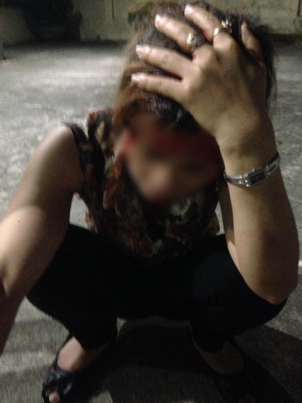 Sốc: Chồng giúp bồ nhí đánh ghen ngược với vợ và con gái khiến nạn nhân chảy máu đầu, phải khâu ngay tại chỗ