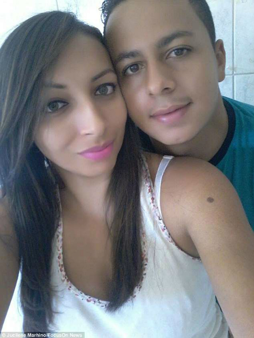 Cô gái không có âm đạo được bác sĩ tái tạo sinh dục bằng da cá