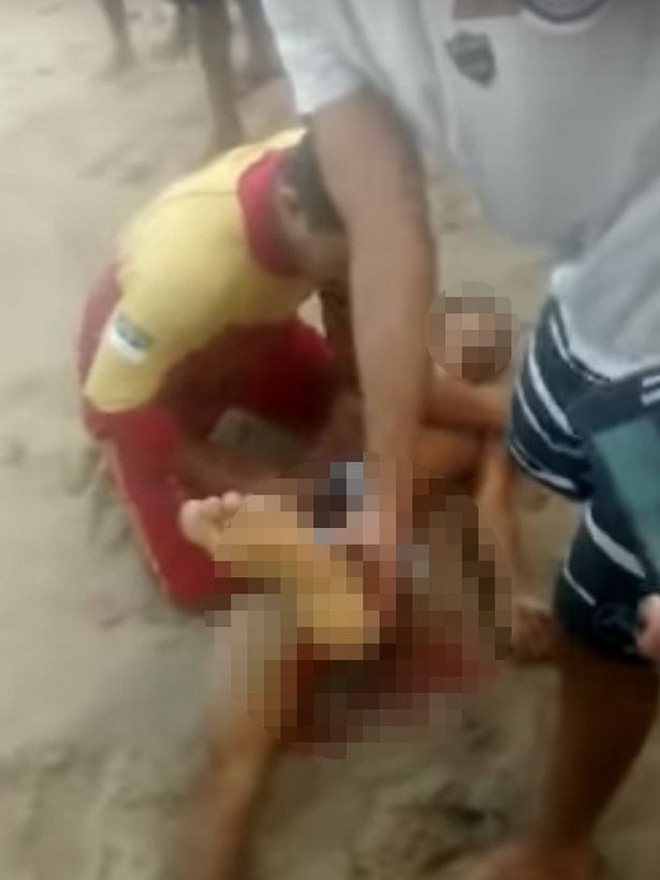 Đi bơi tại vùng biển có cảnh báo nguy hiểm, thanh niên Brazil bị cá mập cắn đứt của quý