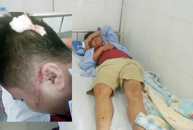 Con uống sữa không may trớ trên ô tô khách, hai người bị truy sát dã man