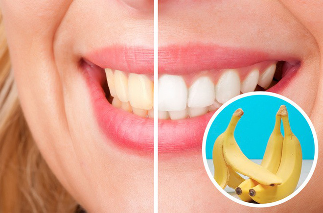 13 mẹo vặt cứu nguy chị em trong những tình huống dở khóc dở cười 13 mẹo vặt cứu nguy chị em trong những tình huống dở khóc dở cười