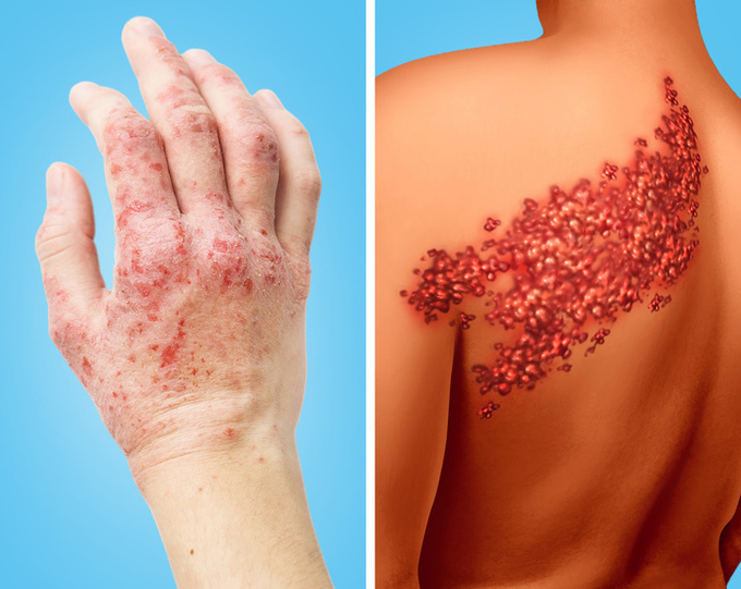 8 dấu hiệu cảnh báo tim của bạn đang có vấn đề