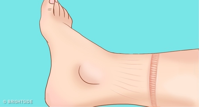 8 dấu hiệu cảnh báo tim của bạn đang có vấn đề