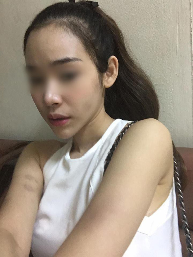 Chồng hỏi em cần gì nhất?, cô vợ trẻ trả lời câu này liền bị đánh khiến cộng đồng chị em dậy sóng