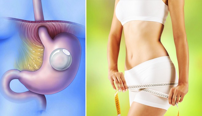 12 người đã tử vong sau khi thử cách giảm cân phổ biến này: Đây là những gì bạn nên biết để tránh