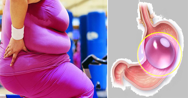 12 người đã tử vong sau khi thử cách giảm cân phổ biến này: Đây là những gì bạn nên biết để tránh