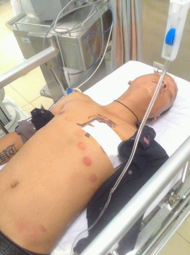 Nam thanh niên sát hại bạn gái trong phòng trọ rồi tự tử