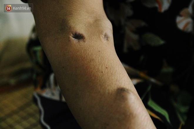 Cụ bà xa quê 11 năm, ở trọ Hà Nội để chạy thận và sống nhờ những vần thơ của chồng: Lấy người xấu trai, sau này người ta chiều mình