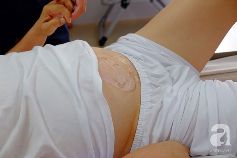 TP.HCM: Vợ con vỡ òa khi thấy chồng ngồi dậy thần kỳ sau 5 năm liệt tứ chi vì tai nạn giao thông cực nặng