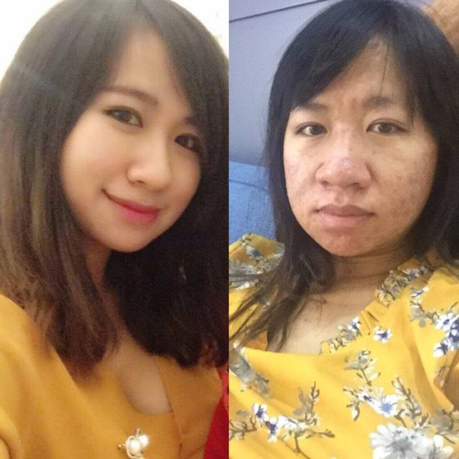 Chia sẻ hình ảnh trước và sau khi có thai với dung nhan một trời một vực, chị gái này đã chứng minh: Phụ nữ xấu nhất lúc mang bầu! Chia sẻ hình ảnh trước và sau khi có thai với dung nhan một trời một vực, chị gái này đã chứng minh: Phụ nữ xấu nhất lúc mang bầu!