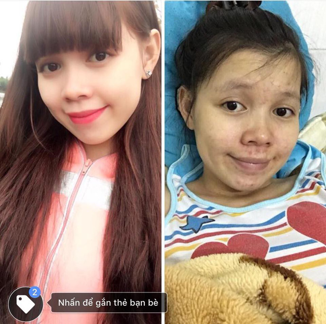 Chia sẻ hình ảnh trước và sau khi có thai với dung nhan một trời một vực, chị gái này đã chứng minh: Phụ nữ xấu nhất lúc mang bầu! Chia sẻ hình ảnh trước và sau khi có thai với dung nhan một trời một vực, chị gái này đã chứng minh: Phụ nữ xấu nhất lúc mang bầu!