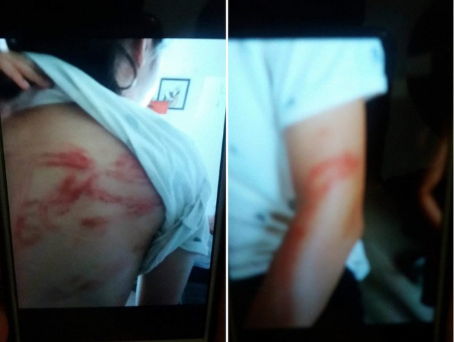 Hà Nội: 2 cháu bé bị bố đẻ khóa trái cửa bạo hành dã man, bà ngoại gửi đơn cầu cứu