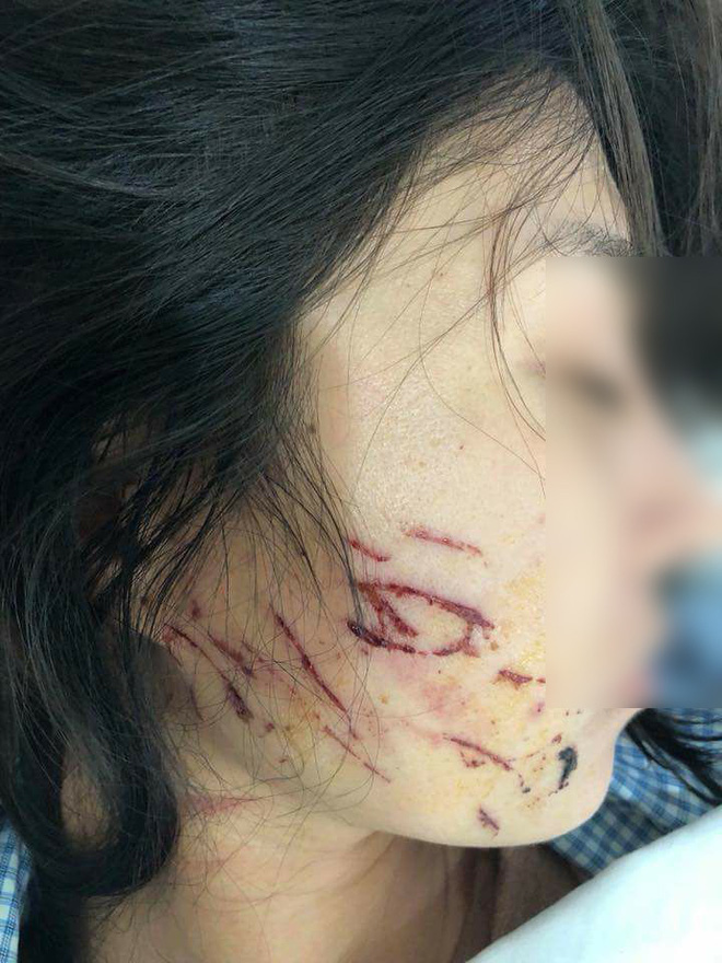 Vụ người phụ nữ bị lột đồ, đổ nước mắm ở Thanh Hóa: Báo cáo Bộ Công an về hành vi Làm nhục người khác