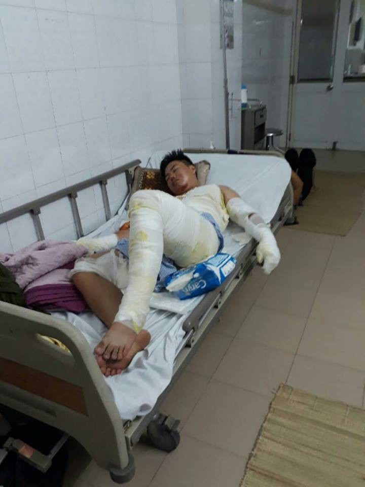 Hành trình phục hồi từ cơ thể bị bỏng nặng 40% đến body cơ bắp khỏe mạnh của chàng trai Thái Nguyên