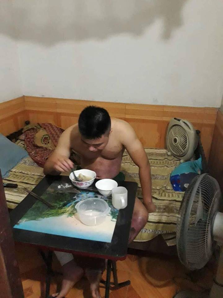 Hành trình phục hồi từ cơ thể bị bỏng nặng 40% đến body cơ bắp khỏe mạnh của chàng trai Thái Nguyên