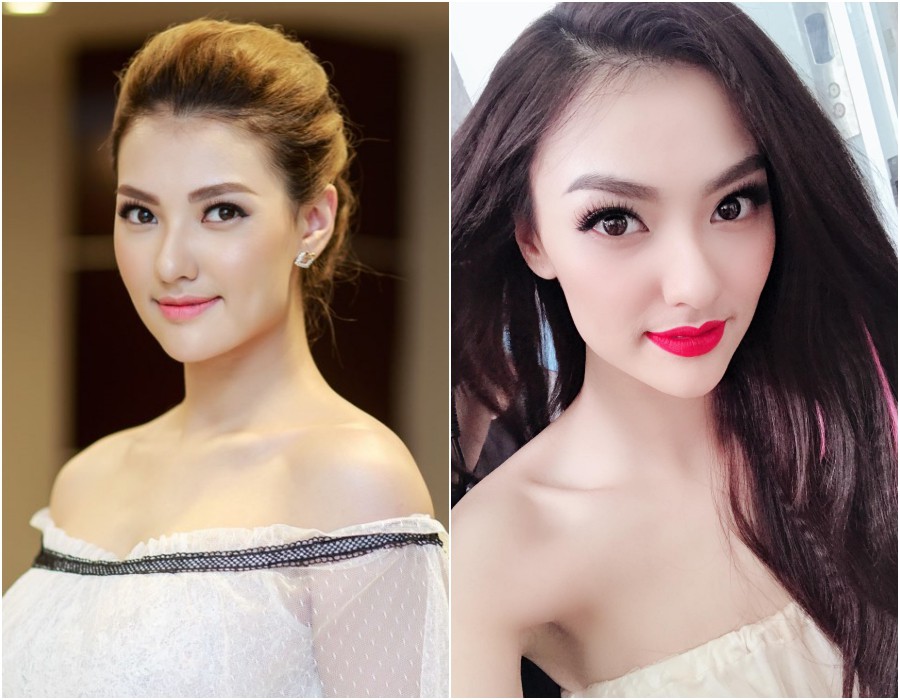 Hồng Quế nói gì trước nghi vấn gương mặt nhọn bất thường vì dao kéo?