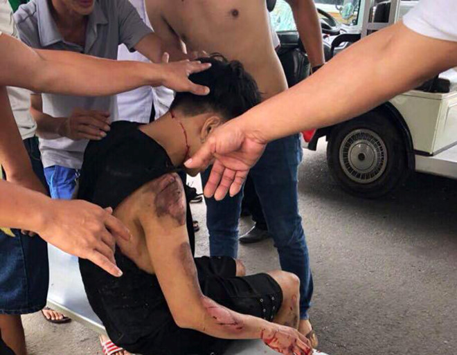 Xe điện tông du khách ở Bà Nà, 6 người bị thương