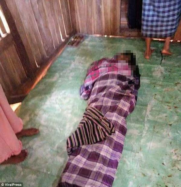 Mổ bụng trăn khổng lồ, kinh hãi phát hiện thi thể người phụ nữ nằm gọn bên trong