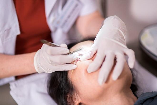 Sơ cứu khi bị dị vật rơi vào mắt, tránh nhiễm trùng mắt cũng như nguy cơ mù lòa