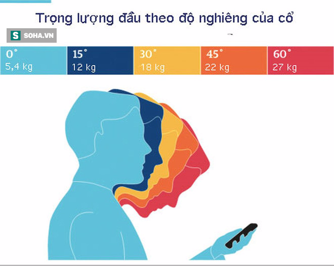 Cảnh báo: Bé 9 tuổi biến dạng xương cổ do xem điện thoại, cha mẹ phát hiện thì đã quá muộn