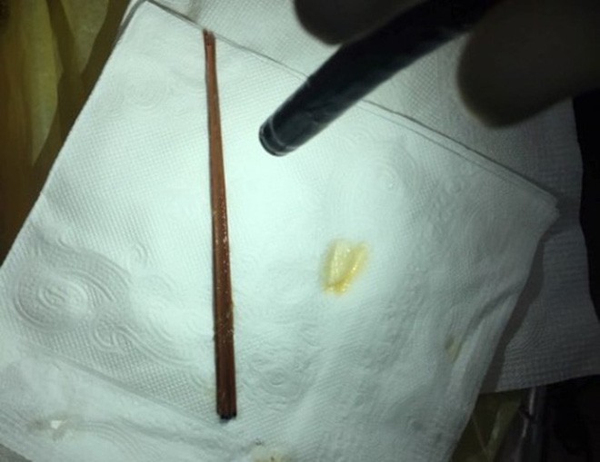 Uống thuốc chưa bóc vỏ, người đàn ông ở Sài Gòn suýt chết vì ho ra máu 3 ngày liên tục