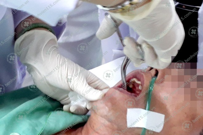 Uống thuốc chưa bóc vỏ, người đàn ông ở Sài Gòn suýt chết vì ho ra máu 3 ngày liên tục