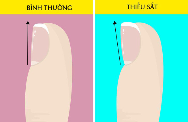 Hãy nhìn xuống đôi chân mình và xem nó đang cảnh báo bạn những vấn đề gì về sức khỏe Hãy nhìn xuống đôi chân mình và xem nó đang cảnh báo bạn những vấn đề gì về sức khỏe