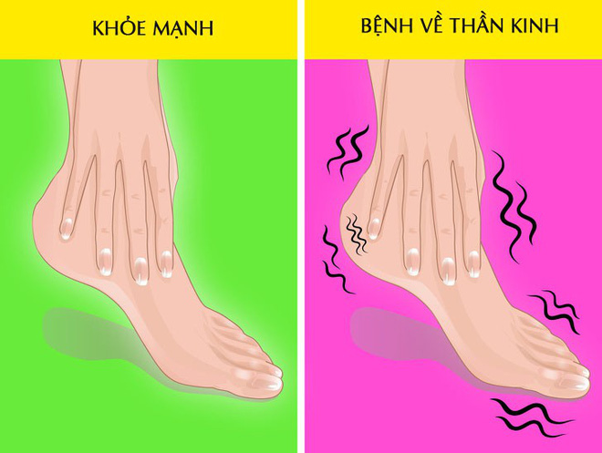Hãy nhìn xuống đôi chân mình và xem nó đang cảnh báo bạn những vấn đề gì về sức khỏe Hãy nhìn xuống đôi chân mình và xem nó đang cảnh báo bạn những vấn đề gì về sức khỏe