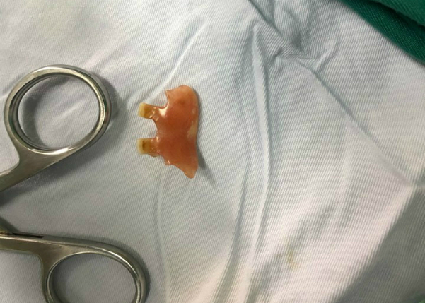 Cụ ông ăn sáng nuốt luôn cả hàm răng giả