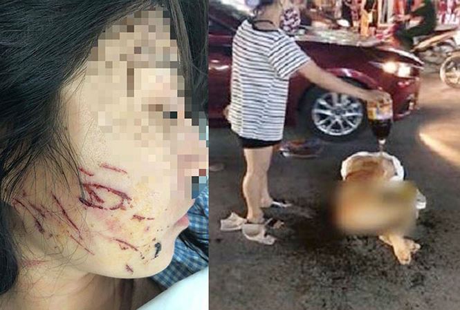 Ba phụ nữ bị khởi tố vì lột đồ đổ nước mắm vào người cô gái trẻ