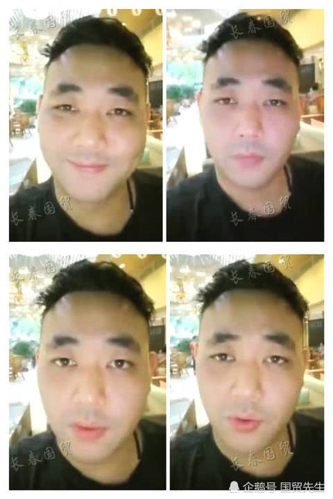 Tiểu Long Nhân: Sao nhí hết thời, hói đầu và già nua ở tuổi 34